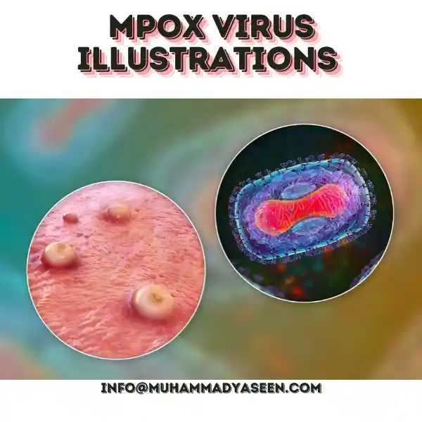 MPOX VIRUS ILLUSTRATIONS